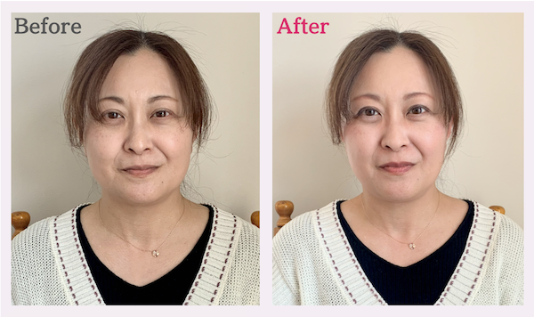 美顔バランス診断の顔タイプ結果が凛×凛タイプのビフォーアフター
